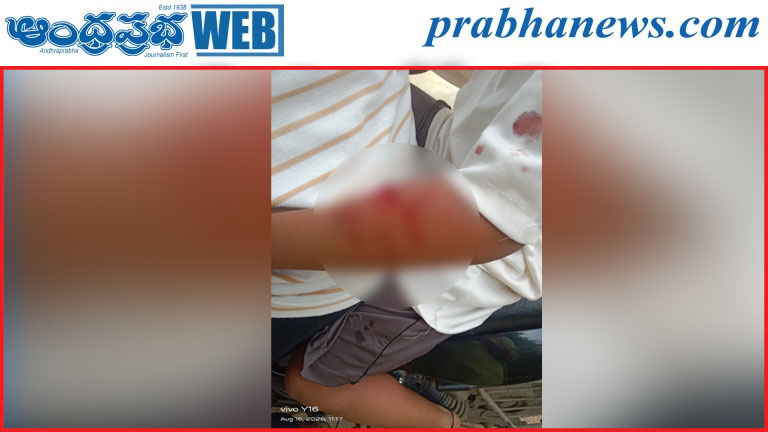 ఊర కుక్కల బెడద.. ప్రజలు భయాందోళన