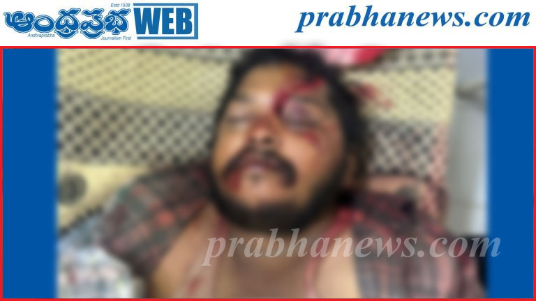 ఆగి ఉన్న వాహనాన్ని ఢీకొని యువకుడు దుర్మరణం