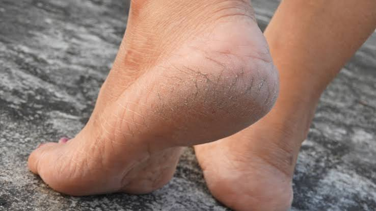 Foot Care Tips