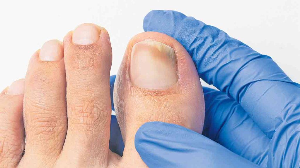 Foot Care Tips