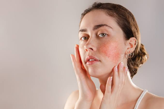 Healthy Skin Tips